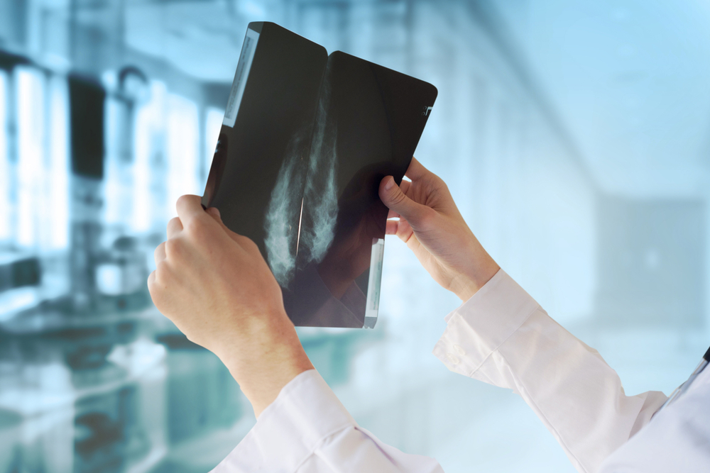 3D Mammography Q&A with Dr. Lloyd